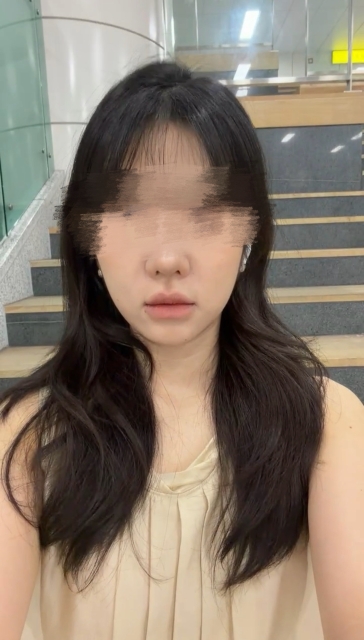 올타이트 리프팅 후기