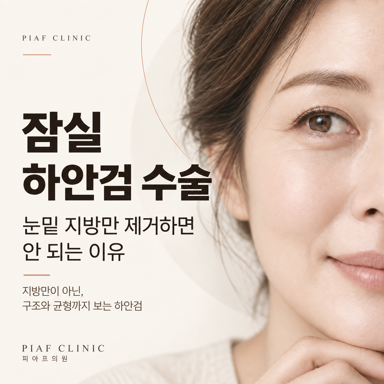 잠실 하안검 수술, 눈밑지방제거보다 중요한 3가지