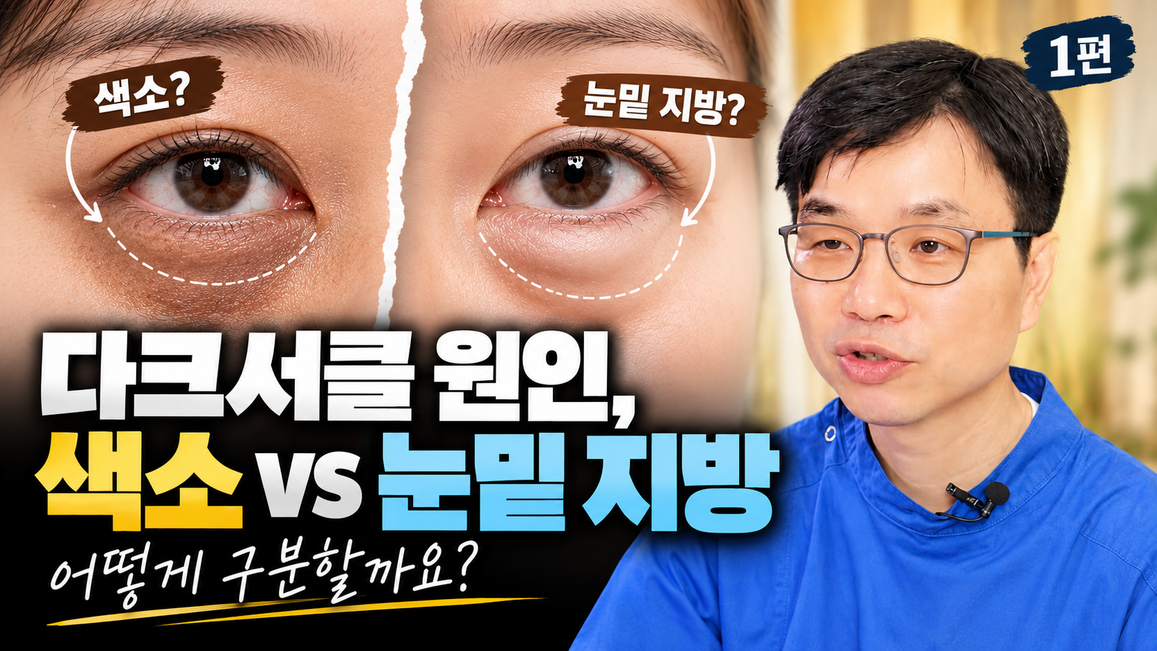 다크서클 원인, 색소 때문일까 눈밑 지방 때문일까? 구분하는 방법 (눈밑, 손일영의 기준 1편)