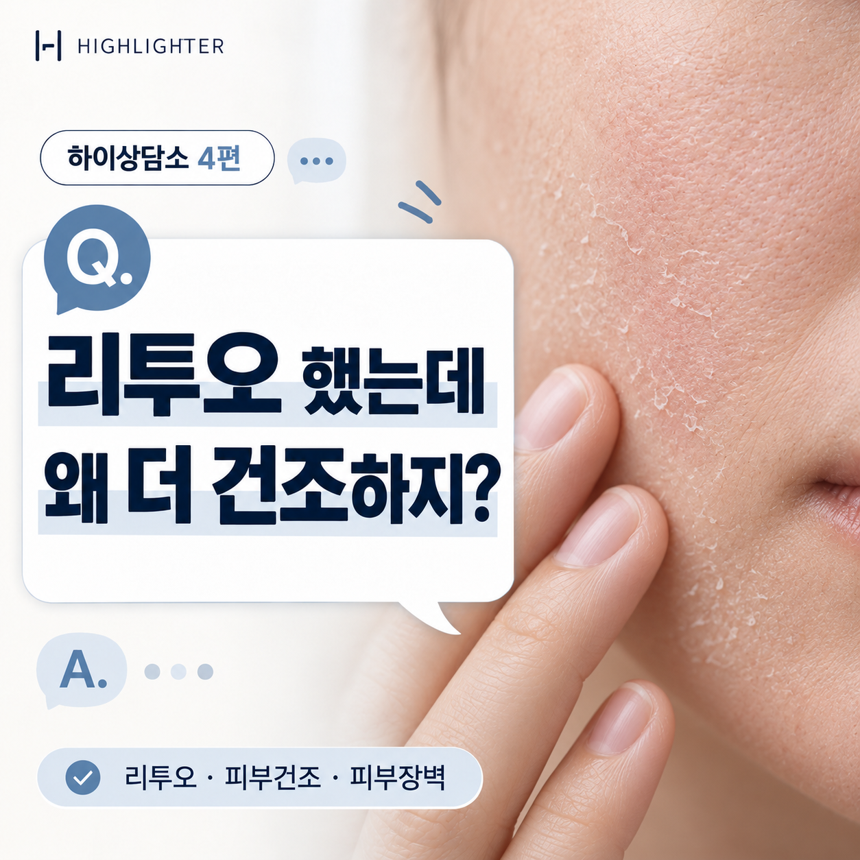 대구 리투오 후 피부 건조함, 시술 후 나타날 수 있는 반응일까요? [하이상담소 4편]