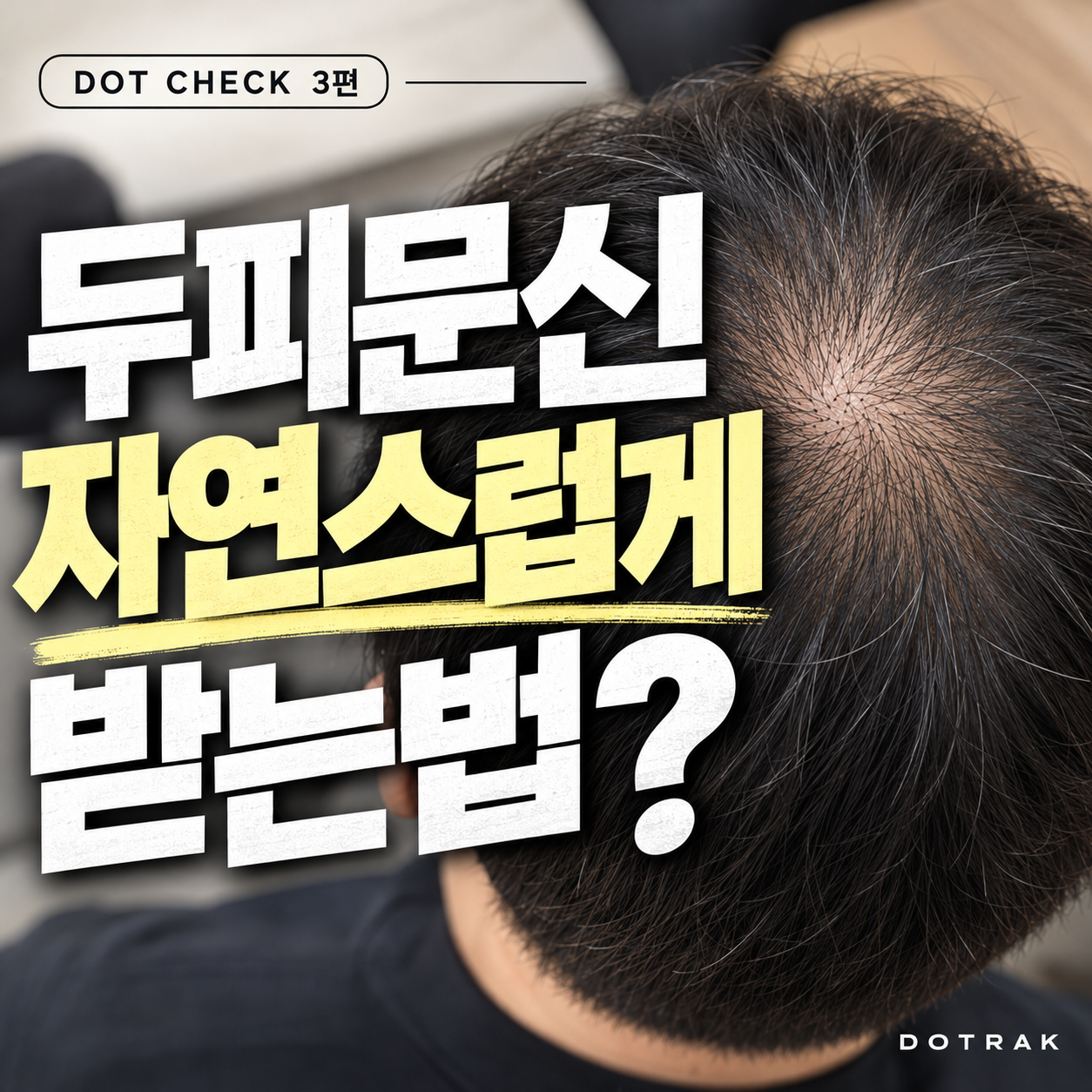강남 두피문신 몇 회 받아야 자연스러울까요? 3~4회차 완성을 보는 이유 | DOT CHECK 3편