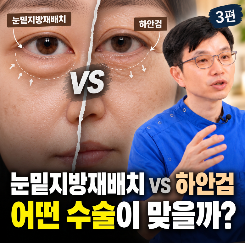 눈밑지방재배치 vs 하안검, 어떤 수술이 맞을까요? 차이와 선택 기준 (눈밑, 손일영의 기준 3편)