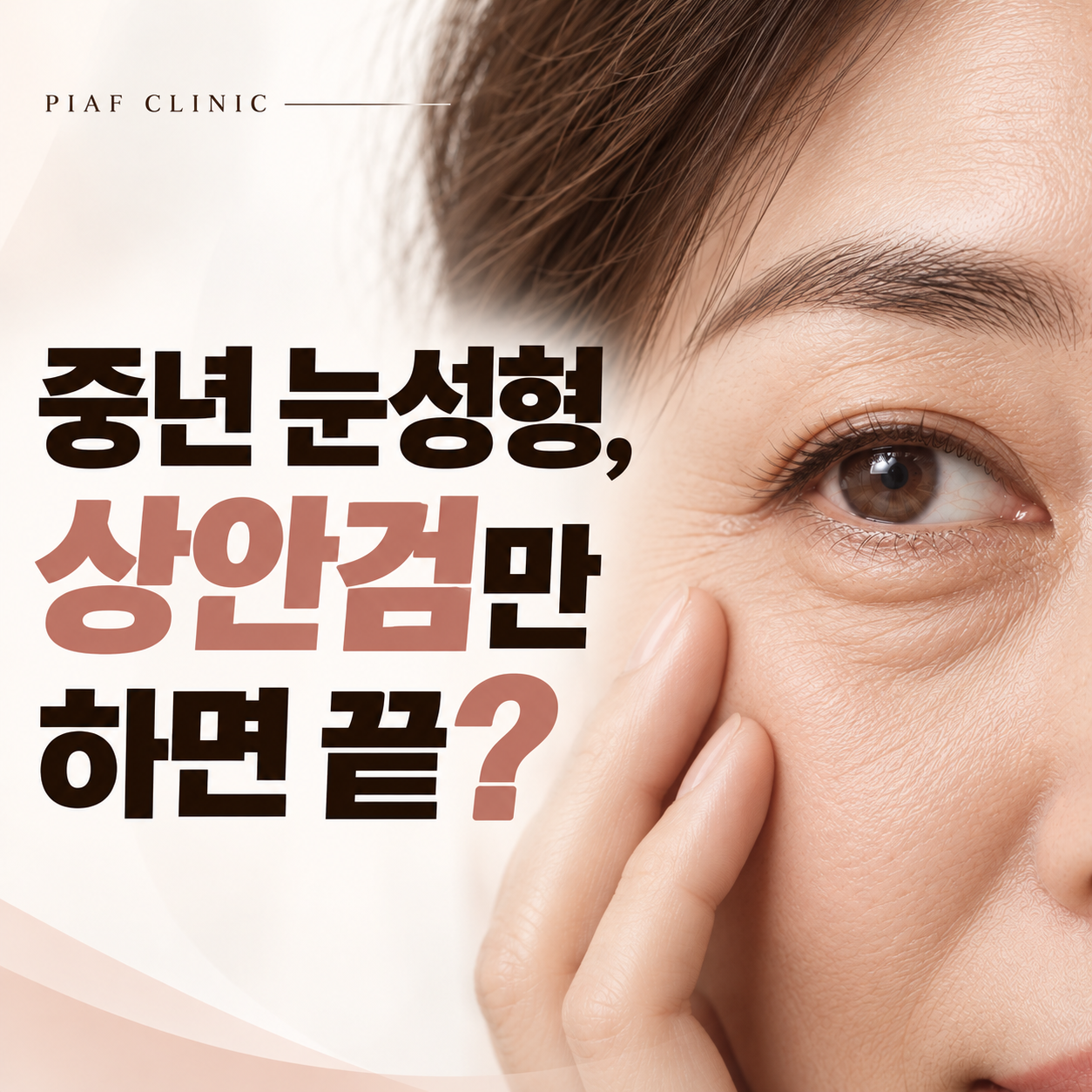 중년 눈 성형, 상안검 수술만 하면 될까요? 하안검까지 봐야 하는 이유