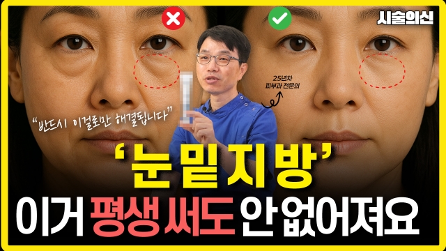 눈밑지방재배치 시술의 신 손일영 원장 1편