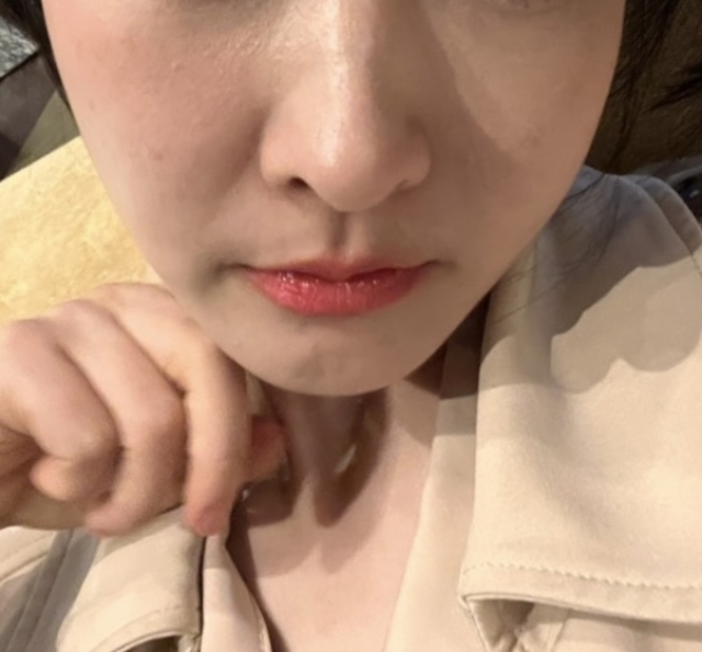 고트의원 솔직한 후기 